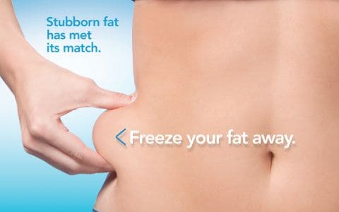 Hips treatment Waltham Forest From Lipo Sculpt