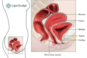 Treatment For A Leaky Bladder 2 How EM Chair treatment Waltham Forest can help Leaky bladder issues. Read more now!