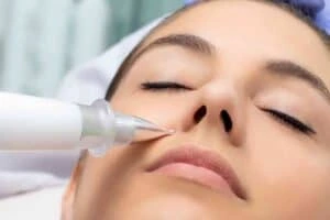 Best Actinic Keratoses Removal 3 Actinic keratoses Waltham Forest solutions - book in today!