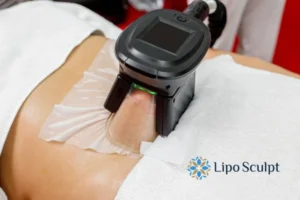 Does Fat Freezing At Home Work? 3 Fat freezing at home from Lipo Sculpt Waltham Forest